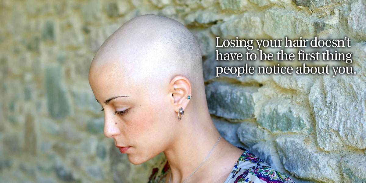 Alopecia Losing your hair doesn't have to be the first thing people notice about you